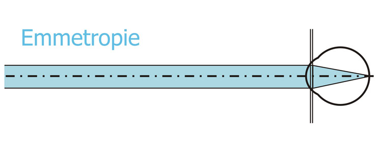 Emmetropie