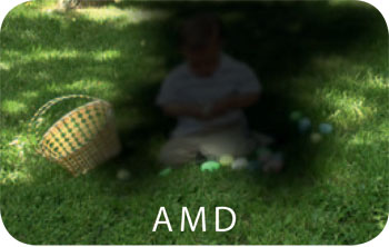 AMD