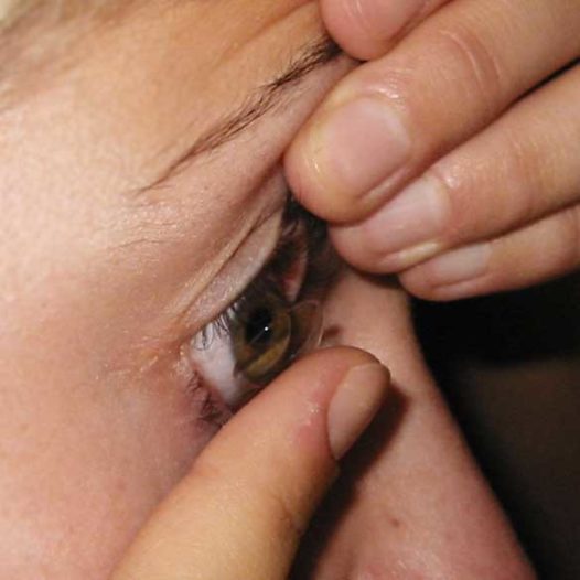April 2022: Zweitages Intensivseminar Kontaktlinsen Assistent_in