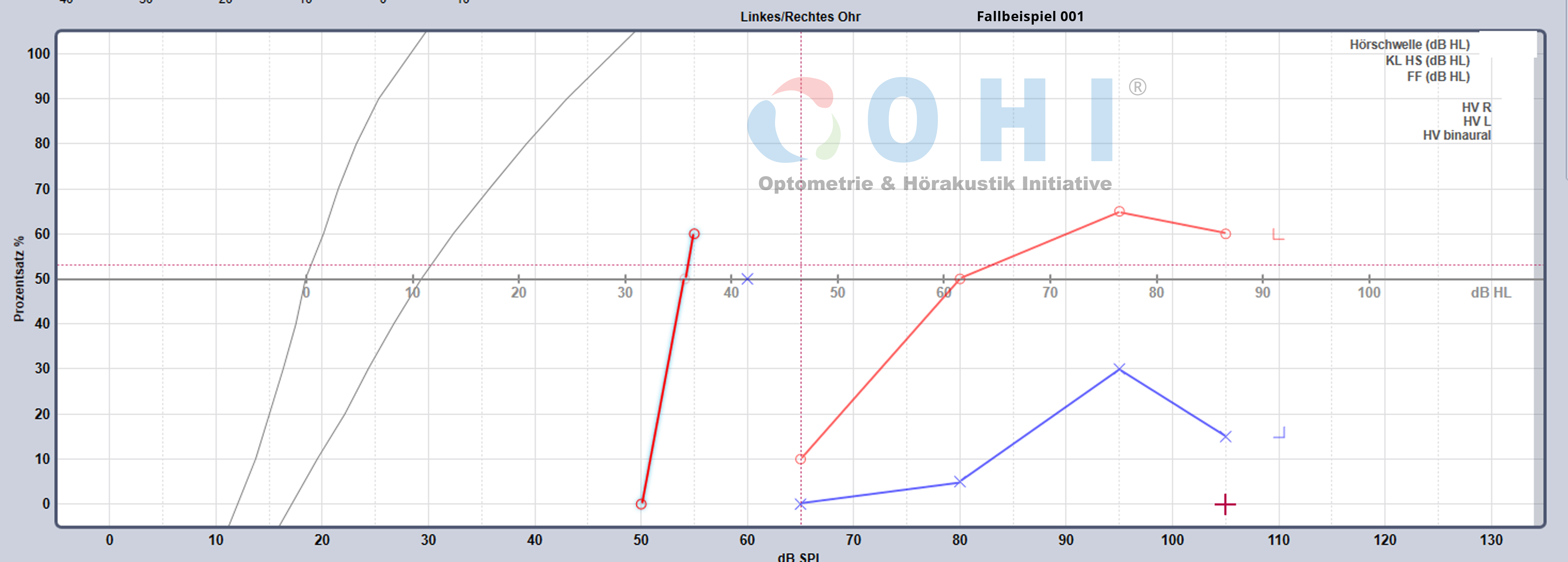 OHI Testaudiogramm 001 SA