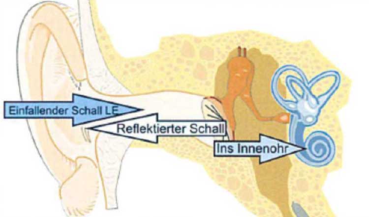 Tympanometrie