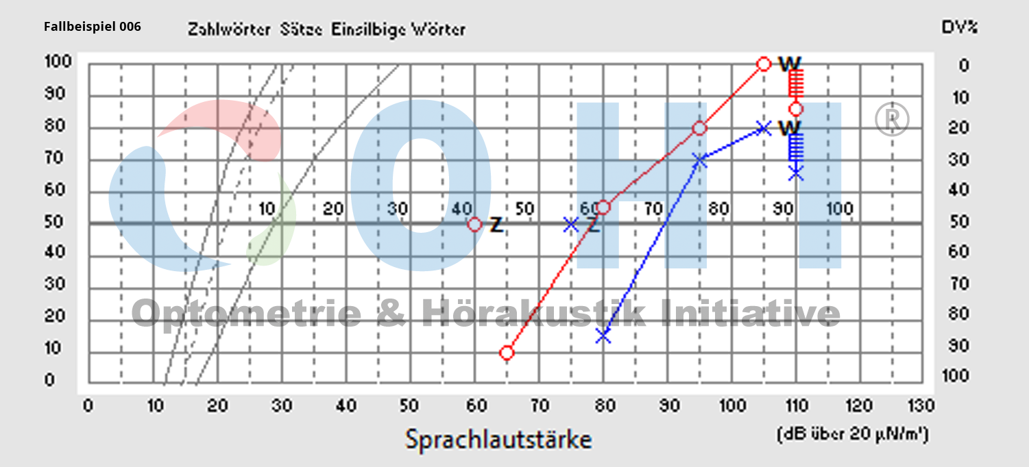 OHI Testaudiogramm 006 SA