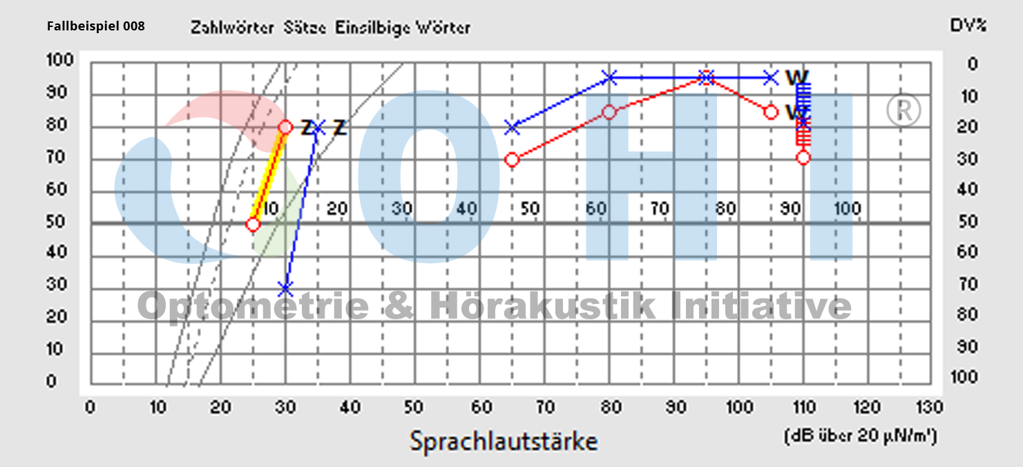 Testaudiogramm 008 SA