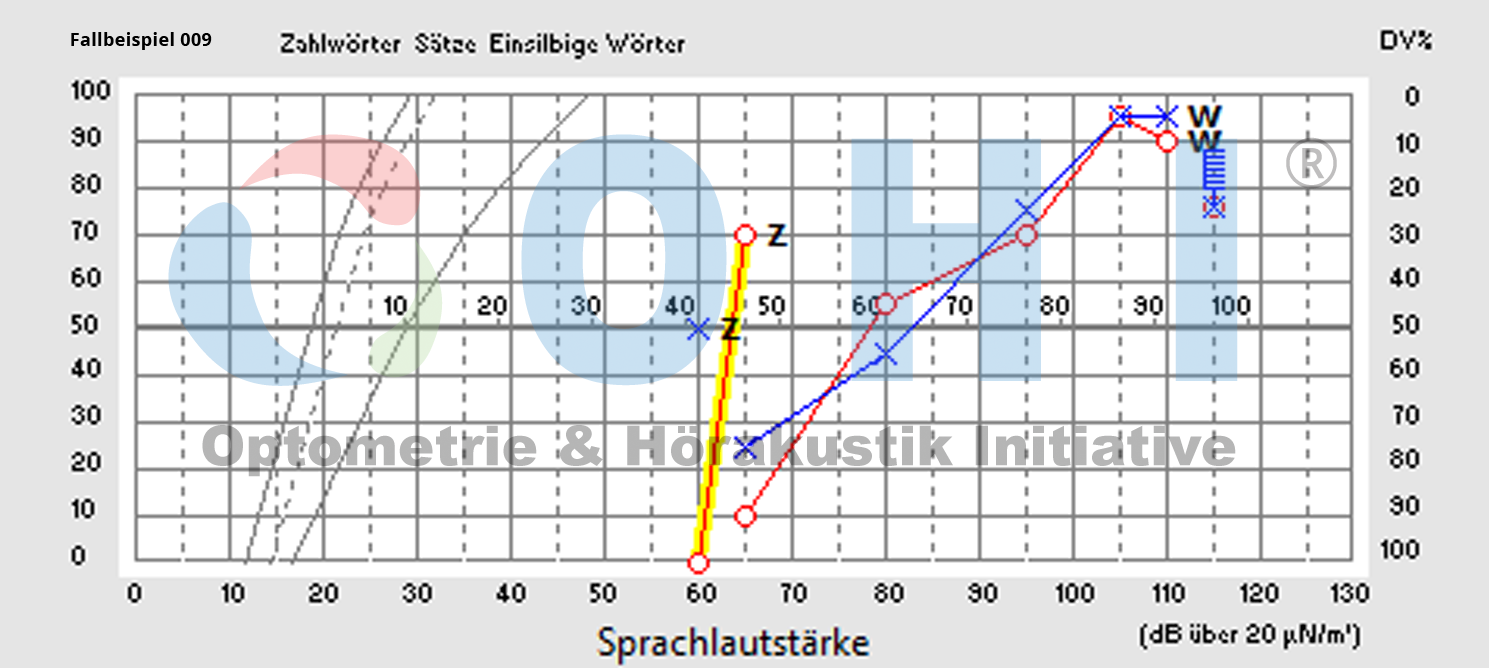 Testaudiogramm 009 SA
