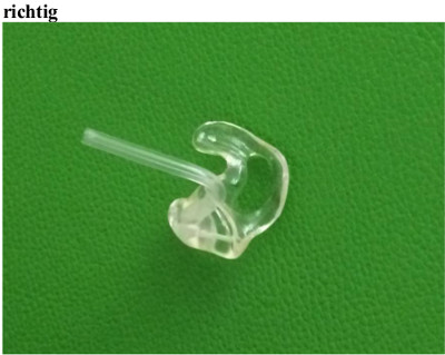 Korrekte Otoplastik