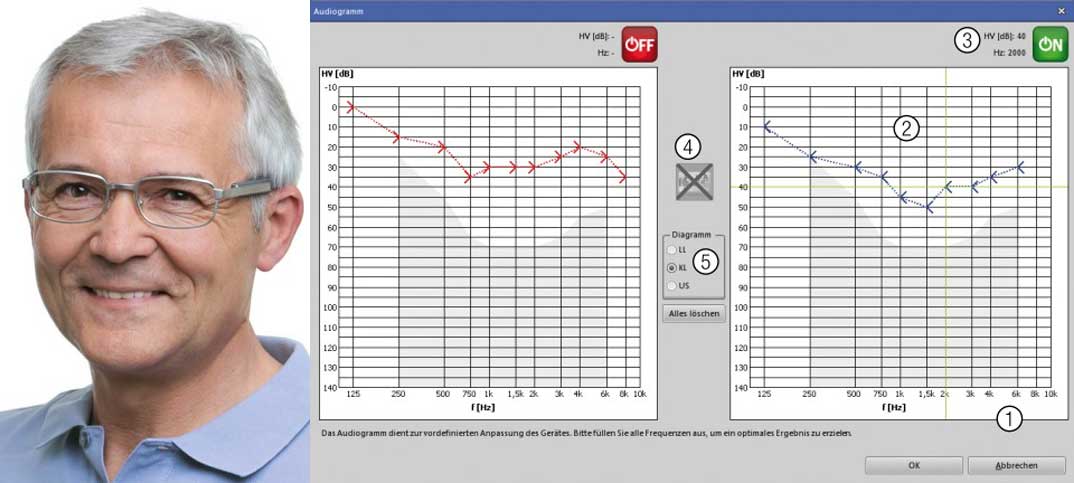 Reintonaudiometrie – Schwerpunkt Knochenleitung