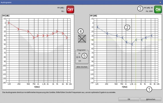 Die In-Situ Audiometrie kann zwischen 125 Hz und 10 kHz durchgeführt werden
