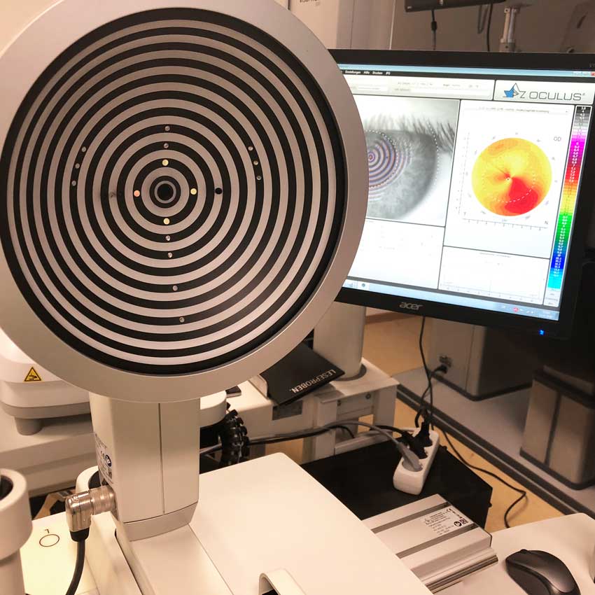 OCULUS Keratograph 5M Bedienungsanleitung