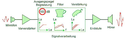 Vereinfachtes Blockschaltbild eines analogen Hörsystems