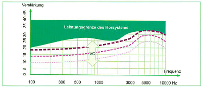 Funktion des Lautstärkestellers