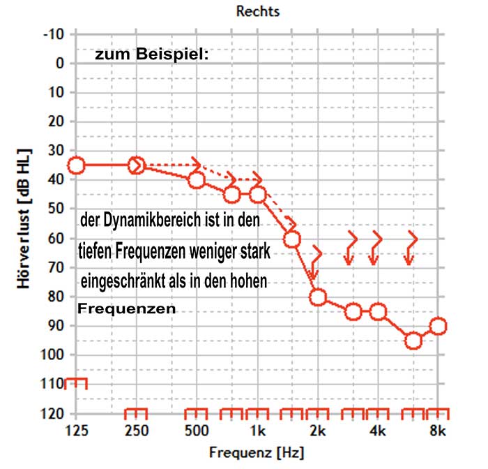 Der Dynamikbereich des Normalhörenden beträgt 100dB