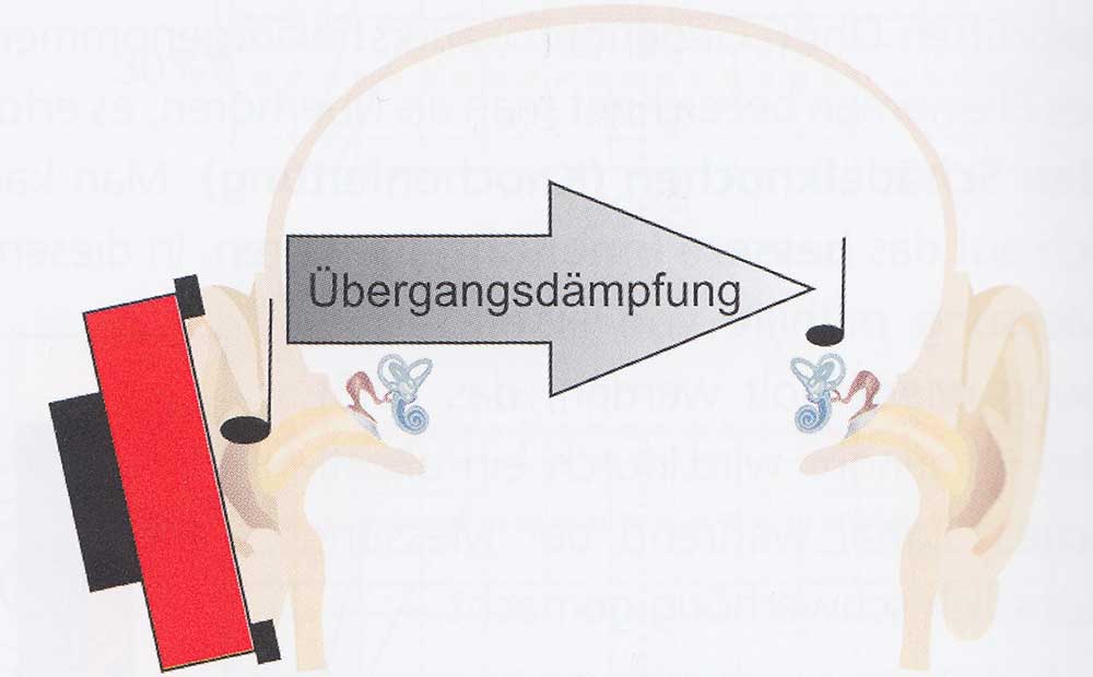 Übergangsdämpfung