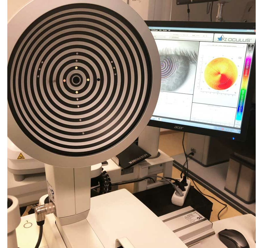 OCULUS Keratograph 5M Bedienungsanleitung